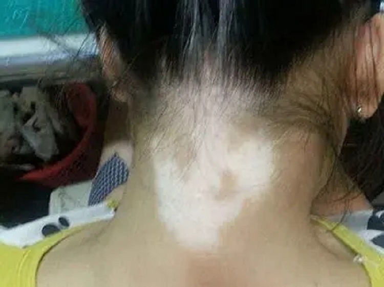 中山肤斗士皮肤病门诊部怎么样